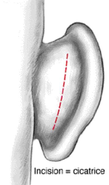 oreille structure